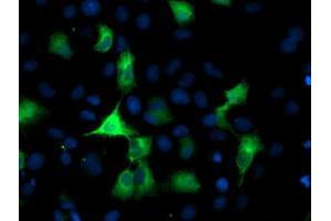 Anti-PFKP mouse monoclonal antibody (ABIN2455341) immunofluorescent staining of COS7 cells transiently transfected by pCMV6-ENTRY PFKP (RC200673). (PFKP 抗体)