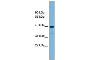 WB Suggested Anti-CRTAP Antibody Titration:  0. (CRTAP 抗体  (N-Term))