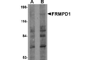 Western Blotting (WB) image for anti-FERM and PDZ Domain Containing 1 (FRMPD1) (C-Term) antibody (ABIN1030403) (FRMPD1 抗体  (C-Term))