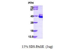Annexin A8 (ANXA8) (AA 1-327) protein (His tag)