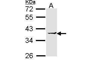 Western Blotting (WB) image for anti-Eukaryotic Translation Elongation Factor 1 delta (Guanine Nucleotide Exchange Protein) (EEF1D) antibody (ABIN2855349)
