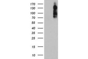HEK293T cells were transfected with the pCMV6-ENTRY control (Left lane) or pCMV6-ENTRY ENPEP (Right lane) cDNA for 48 hrs and lysed. (ENPEP 抗体)