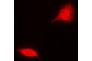 Immunofluorescent analysis of Aspartoacylase staining in MCF7 cells. (ASPA 抗体)