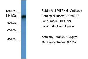 WB Suggested Anti-PITPNM1  Antibody Titration: 0. (PITPNM1 抗体  (N-Term))