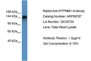 WB Suggested Anti-PITPNM1  Antibody Titration: 0.