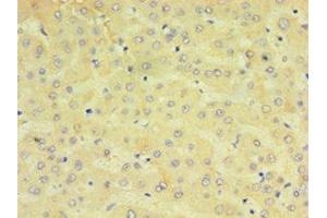 Immunohistochemistry (IHC) image for anti-Cytochrome P450, Family 2, Subfamily J, Polypeptide 2 (CYP2J2) (AA 328-502) antibody (ABIN7149253)