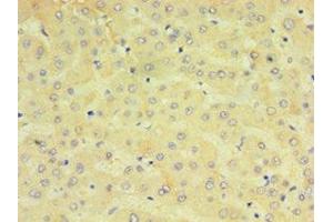 Immunohistochemistry of paraffin-embedded human liver tissue using ABIN7149253 at dilution of 1:100 (CYP2J2 抗体  (AA 328-502))