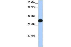LDHB antibody used at 1 ug/ml to detect target protein. (LDHB 抗体  (C-Term))
