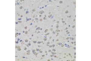 Immunohistochemistry of paraffin-embedded mouse brain using MAPK1 antibody (ABIN4904300) at dilution of 1:100 (40x lens). (ERK2 抗体)