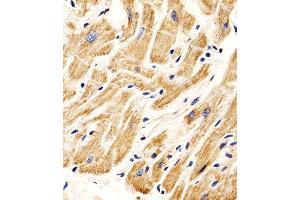 Immunohistochemistry (Paraffin-embedded Sections) (IHC (p)) image for anti-SMAD, Mothers Against DPP Homolog 1 (SMAD1) (AA 163-196) antibody (ABIN6242631)