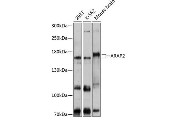 ARAP2 抗体  (AA 1405-1704)