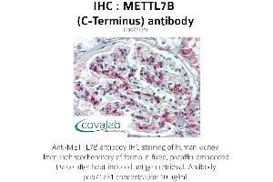 Image no. 2 for anti-Methyltransferase Like 7B (METTL7B) (C-Term) antibody (ABIN1736925) (METTL7B 抗体  (C-Term))