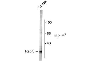 Image no. 1 for anti-RAB3A, Member RAS Oncogene Family (RAB3A) (N-Term) antibody (ABIN372708) (RAB3A 抗体  (N-Term))