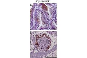 Immunohistochemical staining of tumor biopsy and biopsy spheroid sections.