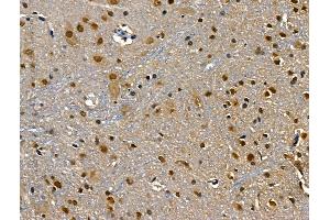 ABIN6260189 and ABIN6268682 at 1/100 staining Rat brain tissue by IHC-P. (BAG1 抗体  (N-Term))