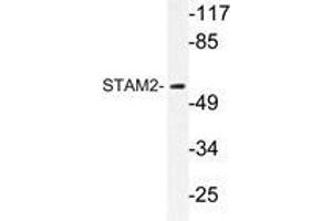 Western blot analysis of STAM2 antibody in extracts from NIH/3T3cells. (STAM2 抗体)
