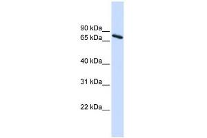 Ubiquilin 1 antibody used at 1 ug/ml to detect target protein. (Ubiquilin 1 抗体  (Middle Region))