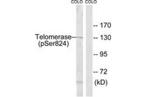 Western blot analysis of extracts from COLO205 cells, using Telomerase (Phospho-Ser824) Antibody. (TERT 抗体  (pSer824))