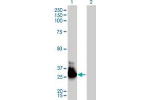 Western Blot analysis of GNA13 expression in transfected 293T cell line by GNA13 monoclonal antibody (M01), clone 6F6-B5. (GNA13 抗体  (AA 1-377))