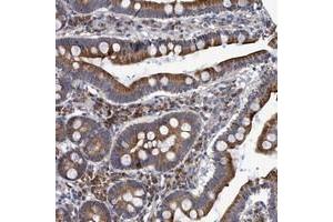 Immunohistochemical staining of human duodenum with NAT16 polyclonal antibody  shows cytoplasmic positivity in glandular cells. (NAT16 抗体)
