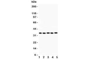 Western blot testing of HOXA11 antibody and Lane 1:  rat brain;  2: human placenta;  3: human HeLa;  4: (h) HT1080;  5: mouse HEPA lysate.