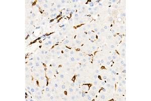 Immunohistochemistry of paraffin-embedded Human liver using CD74 antibody (ABIN7267759) at dilution of 1:100 (40x lens). (CD74 抗体)