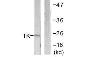 Western blot analysis of extracts from COLO205 cells, using TK (Ab-13) antibody. (TK1 抗体  (Ser13))