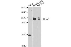 Western blot analysis of extracts of various cell lines, using TIRAP antibody. (TIRAP 抗体  (AA 1-221))