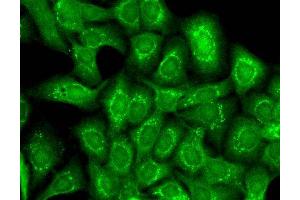 Immunofluorescence (fixed cells) (IF/ICC) image for anti-Potassium Channel, Subfamily T, Member 1 (KCNT1) (AA 1168-1237) antibody (PE) (ABIN2482932)