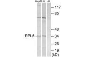Western blot analysis of extracts from Jurkat/HepG2 cells, using RPL5 Antibody. (RPL5 抗体  (AA 161-210))