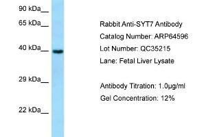 Western Blotting (WB) image for anti-Synaptotagmin VII (SYT7) (N-Term) antibody (ABIN971838) (SYT7 抗体  (N-Term))