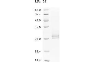 (Tris-Glycine gel) Discontinuous SDS-PAGE (reduced) with 5 % enrichment gel and 15 % separation gel.