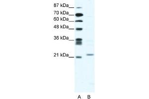WB Suggested Anti-TWIST1 Antibody Titration:  2. (TWIST1 抗体  (C-Term))