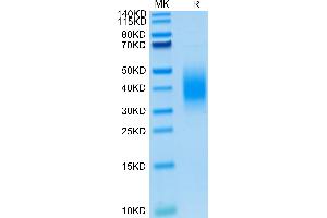 SDS-PAGE (SDS) image for B and T Lymphocyte Associated (BTLA) (AA 30-176) protein (His tag) (ABIN7274000)
