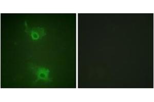 Immunofluorescence analysis of COS7 cells, using S1P Receptor EDG1 (Phospho-Thr236) Antibody. (S1PR1 抗体  (pThr236))