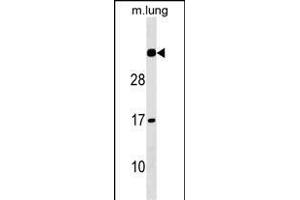 NAT15 Antibody (Center) (ABIN1537826 and ABIN2849865) western blot analysis in mouse lung tissue lysates (35 μg/lane). (NAT15 抗体  (AA 133-160))