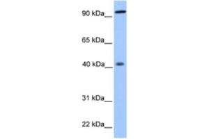 Western Blotting (WB) image for anti-Pygopus Homolog 1 (Drosophila) (PYGO1) antibody (ABIN2463350) (PYGO1 抗体)