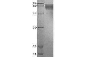 Validation with Western Blot