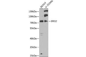 Western blot analysis of extracts of various cell lines, using IFFO2 antibody (ABIN6133429, ABIN6142160, ABIN6142161 and ABIN6223442) at 1:1000 dilution. (IFFO2 抗体)