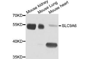 Western blot analysis of extract of various cells, using SLC9A6 antibody. (SLC9A6 抗体)