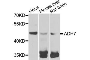 Western blot analysis of extracts of various cell lines, using ADH7 antibody. (ADH7 抗体)