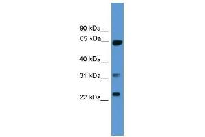 CLTA antibody used at 0. (CLTA 抗体  (C-Term))