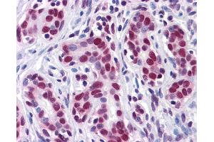 Anti-HuR antibody IHC of human breast. (ELAVL1 抗体  (AA 1-101))