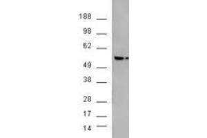 Western Blotting (WB) image for V-Akt Murine Thymoma Viral Oncogene Homolog 3 (Protein Kinase B, Gamma) (AKT3) peptide (ABIN369918) (V-Akt Murine Thymoma Viral Oncogene Homolog 3 (Protein Kinase B, Gamma) (AKT3) Peptide)