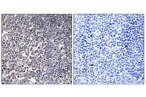 Immunohistochemistry analysis of paraffin-embedded human tonsil tissue using MRPS16 antibody. (MRPS16 抗体  (Internal Region))