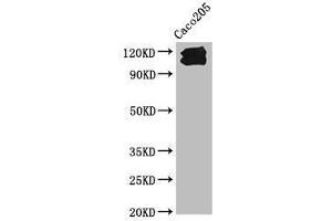 Western Blot Positive WB detected in: Caco205 whole cell lysate All lanes: CDH1 antibody at 1:1000 Secondary Goat polyclonal to Mouse IgG at 1/10000 dilution Predicted band size: 98, 91 kDa Observed band size: 110, 120 kDa (E-cadherin 抗体  (AA 155-707))