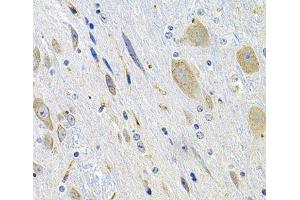 Immunohistochemistry of paraffin-embedded Mouse brain using LGR6 Polyclonal Antibody at dilution of 1:100 (40x lens). (LGR6 抗体)