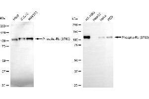 anti-Retinoblastoma Protein (Rb Protein) (pSer780) antibody