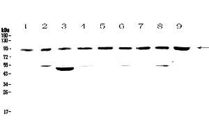 Western blot analysis of Cullin 5 using anti-Cullin 5 antibody . (Cullin 5 抗体  (AA 2-105))