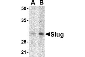 Western Blotting (WB) image for anti-SLUG (Middle Region 1) antibody (ABIN1031191) (SLUG 抗体  (Middle Region 1))